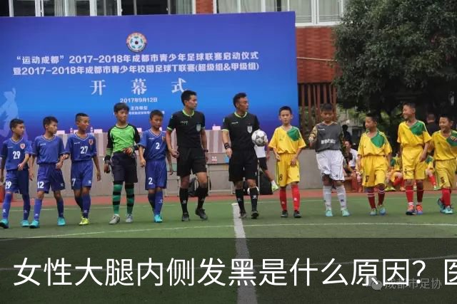 女性大腿内侧发黑是什么原因？医生：别惊慌，这3个常识需了解
